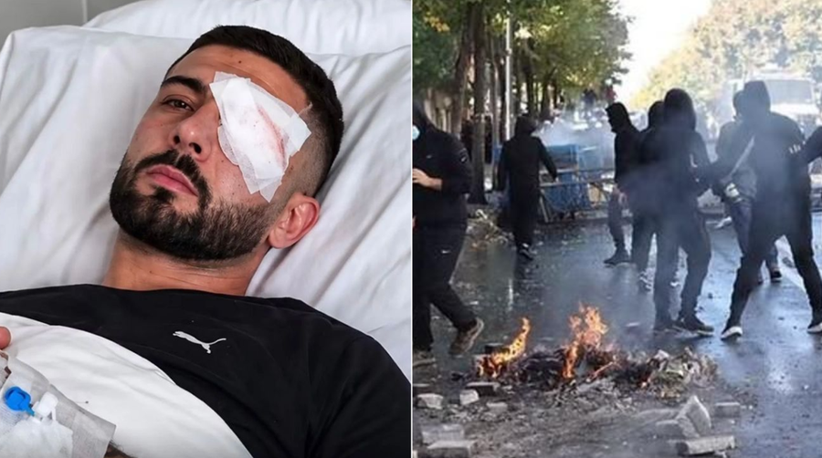U plagos në sy gjatë protestës, Prokuroria e Tiranës nis hetim për rastin e Erion Vishkullit dhe dhunën e policisë në protesta