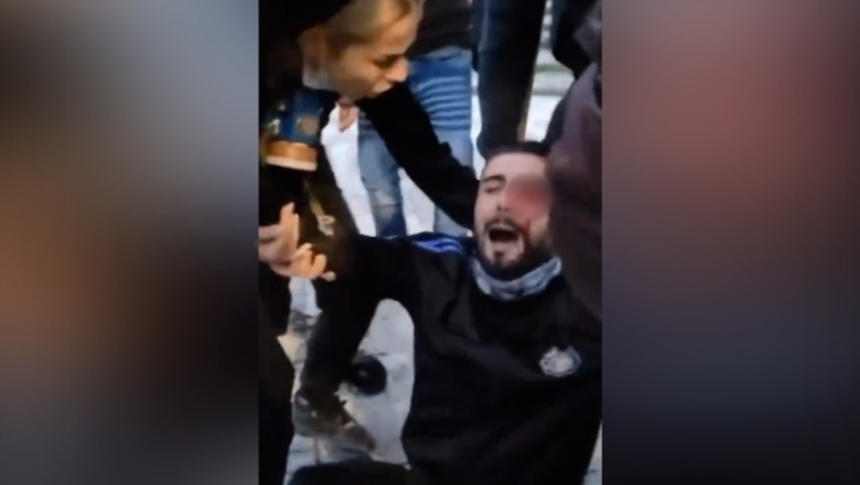 Tjetër moment i rëndë nga protesta: I riu goditet në sy me plumb gome