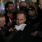 Luçiano Boçi përplaset me policinë: Na sulmuan fizikisht pa motivacion (përfundon në spital)