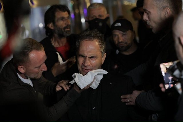 Luçiano Boçi përplaset me policinë: Na sulmuan fizikisht pa motivacion (përfundon në spital)