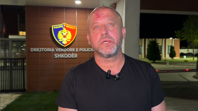 “U rrëzua vetë” – Biznesmeni që akuzohet se dhunoi gazetarin në Shkodër: Unë vetëm e kam shtyrë, ai më shantazhonte