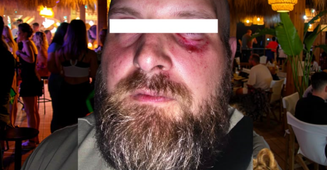 “E rrahën 7 kamarier, policia nuk erdhi” – Dhunohet në club-in e njohur në Golem turisti shqiptaro-gjerman