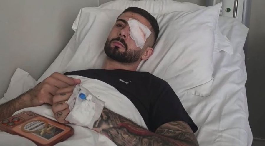 U lëndua në sy gjatë protestës, Qeveria akordon 5 milionë lekë për trajtimin mjekësor të Erion Vishkullit