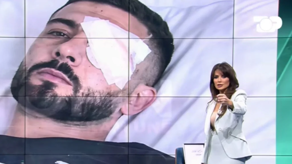 U plagos në sy gjatë protestës, Grida Duma jep detaje për Erjon Vishkullin: Do të operohet nesër në spitalin ku u operua dhe Papa Leone