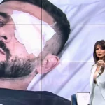 U plagos në sy gjatë protestës, Grida Duma jep detaje për Erjon Vishkullin: Do të operohet nesër në spitalin ku u operua dhe Papa Leone