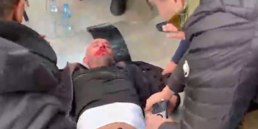 Qytetari dhunohet rëndë nga protestuesit, lahet në gjak nga grushtet e shqelmat