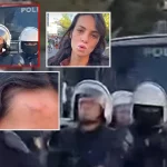 Studentja: Më goditën me shkop gome, ndërkohë që nuk po bëja asgjë